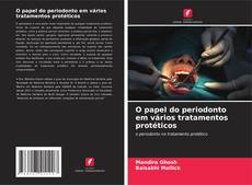 Bookcover of O papel do periodonto em vários tratamentos protéticos