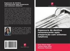 Bookcover of Espessura de dentina remanescente após preparação com sistemas rotativos
