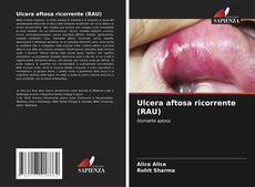 Bookcover of Ulcera aftosa ricorrente (RAU)