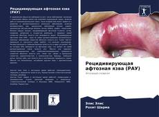 Bookcover of Рецидивирующая афтозная язва (РАУ)