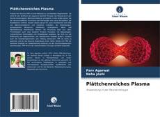 Bookcover of Plättchenreiches Plasma