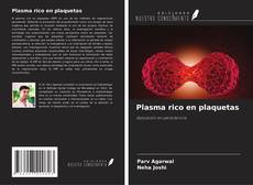 Capa do livro de Plasma rico en plaquetas 
