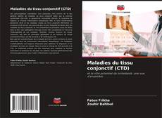 Buchcover von Maladies du tissu conjonctif (CTD)
