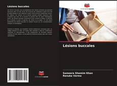 Bookcover of Lésions buccales