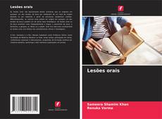 Bookcover of Lesões orais