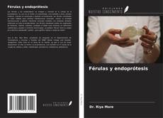 Bookcover of Férulas y endoprótesis