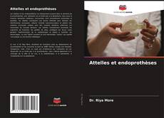 Buchcover von Attelles et endoprothèses