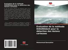 Bookcover of Évaluation de la méthode DIAGNOdent pour la détection des lésions carieuses