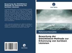 Buchcover von Bewertung der DIAGNOdent-Methode zur Erkennung von kariösen Läsionen
