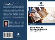 Misserfolge bei Zahnimplantaten & Management kitap kapağı