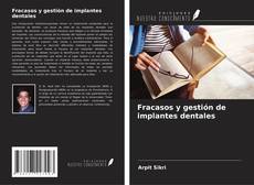 Buchcover von Fracasos y gestión de implantes dentales