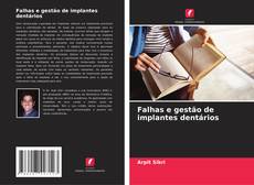 Capa do livro de Falhas e gestão de implantes dentários 