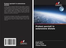 Bookcover of Protesi parziali in estensione distale