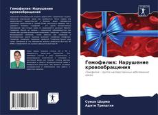 Bookcover of Гемофилия: Нарушение кровообращения