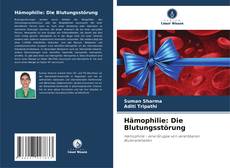 Bookcover of Hämophilie: Die Blutungsstörung