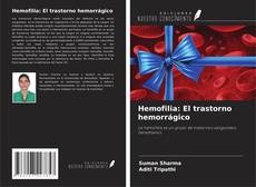 Bookcover of Hemofilia: El trastorno hemorrágico