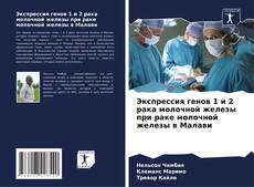 Bookcover of Экспрессия генов 1 и 2 рака молочной железы при раке молочной железы в Малави