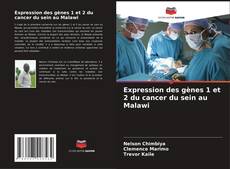 Buchcover von Expression des gènes 1 et 2 du cancer du sein au Malawi
