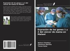 Bookcover of Expresión de los genes 1 y 2 del cáncer de mama en Malawi