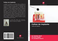Bookcover of Falhas de implante