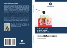 Bookcover of Implantatversagen