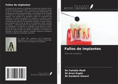 Fallos de implantes kitap kapağı