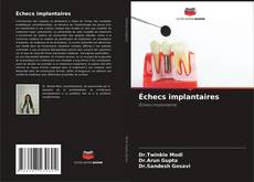 Buchcover von Échecs implantaires