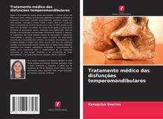 Bookcover of Tratamento médico das disfunções temporomandibulares