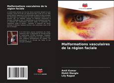 Buchcover von Malformations vasculaires de la région faciale