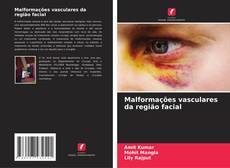 Buchcover von Malformações vasculares da região facial