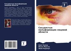 Capa do livro de Сосудистые мальформации лицевой области 