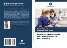 Bookcover of Kunstharzgebundener Stift Endodontische Restauration