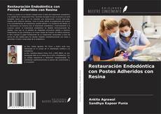 Bookcover of Restauración Endodóntica con Postes Adheridos con Resina