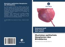 Bookcover of Muzinöse epitheliale Neoplasien des Blinddarms
