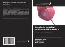 Bookcover of Neoplasia epitelial mucinosa del apéndice