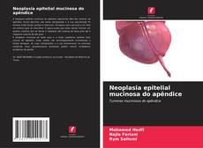Bookcover of Neoplasia epitelial mucinosa do apêndice