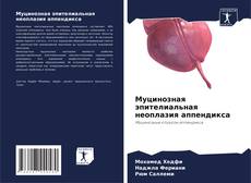 Муцинозная эпителиальная неоплазия аппендикса kitap kapağı
