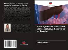Buchcover von Mise à jour sur la maladie veino-occlusive hépatique en Égypte