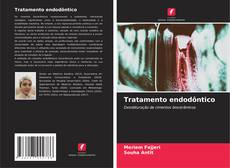 Buchcover von Tratamento endodôntico
