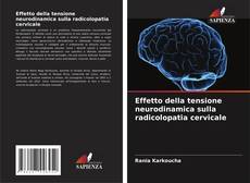 Bookcover of Effetto della tensione neurodinamica sulla radicolopatia cervicale