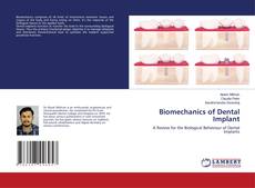 Buchcover von Biomechanics of Dental Implant