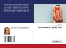 Copertina di Guided tissue regeneration