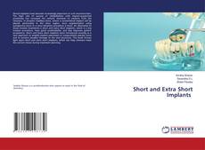Copertina di Short and Extra Short Implants