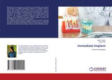 Buchcover von Immediate Implant