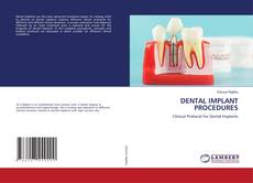 Buchcover von DENTAL IMPLANT PROCEDURES