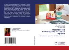 Couverture de Prosthodontic Consideration for Dental Implants