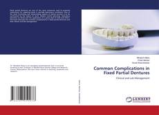 Buchcover von Common Complications in Fixed Partial Dentures
