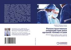 Bookcover of Реконструктивные операции при раке органов головы и шеи