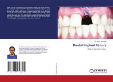 Buchcover von Dental Implant Failure