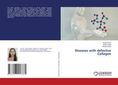 Copertina di Diseases with defective Collagen